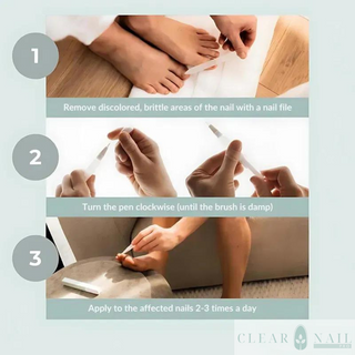 ClearNail Pro™ - Nail Care Pen