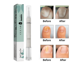 ClearNail Pro™ - Nail Care Pen